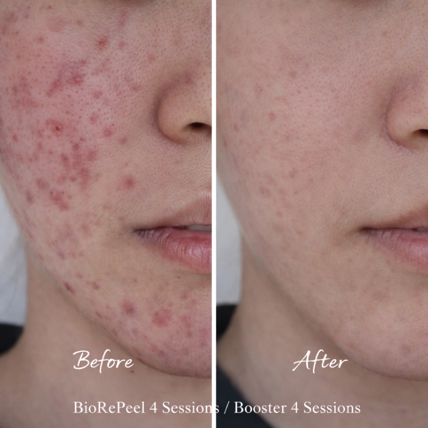 Facial — Before & After 2