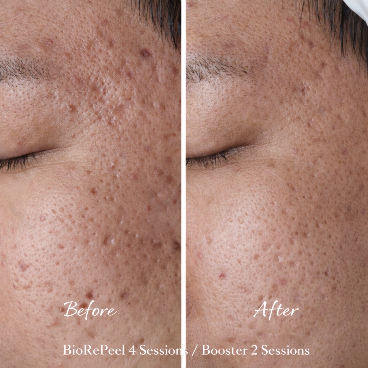 Facial — Before & After 3