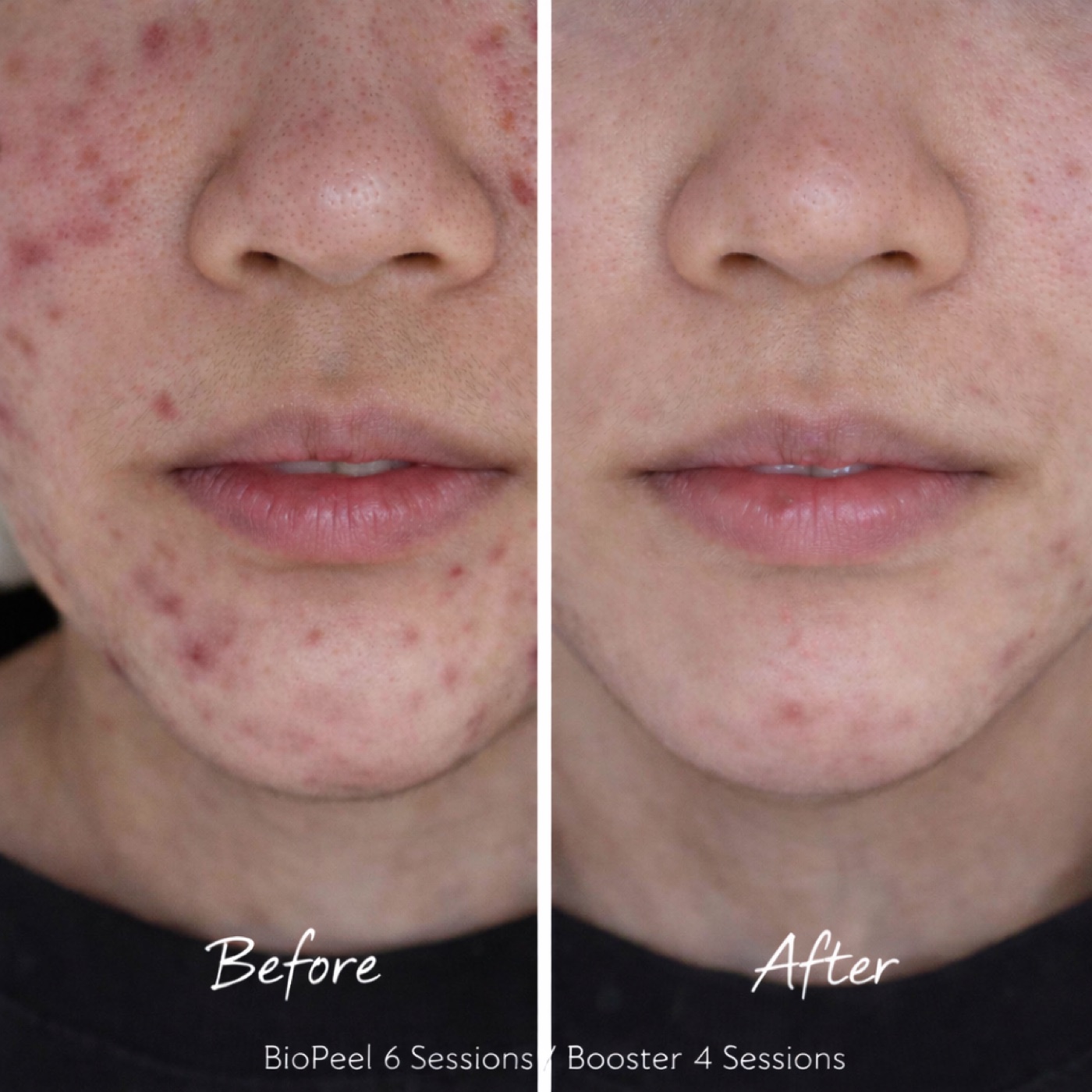 Facial — Before & After 4