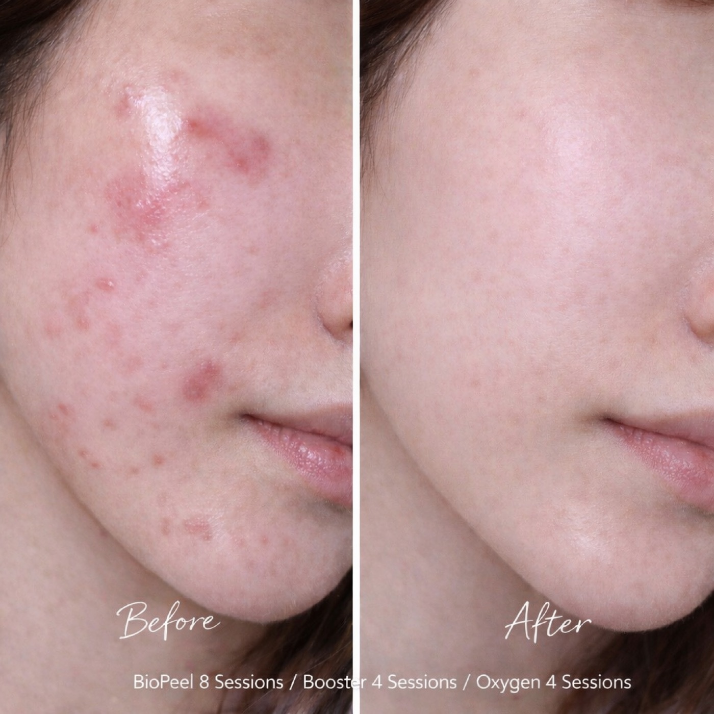 Facial — Before & After 5