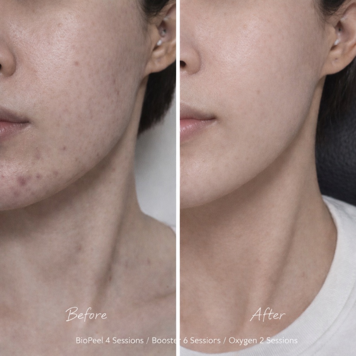 Facial — Before & After 6