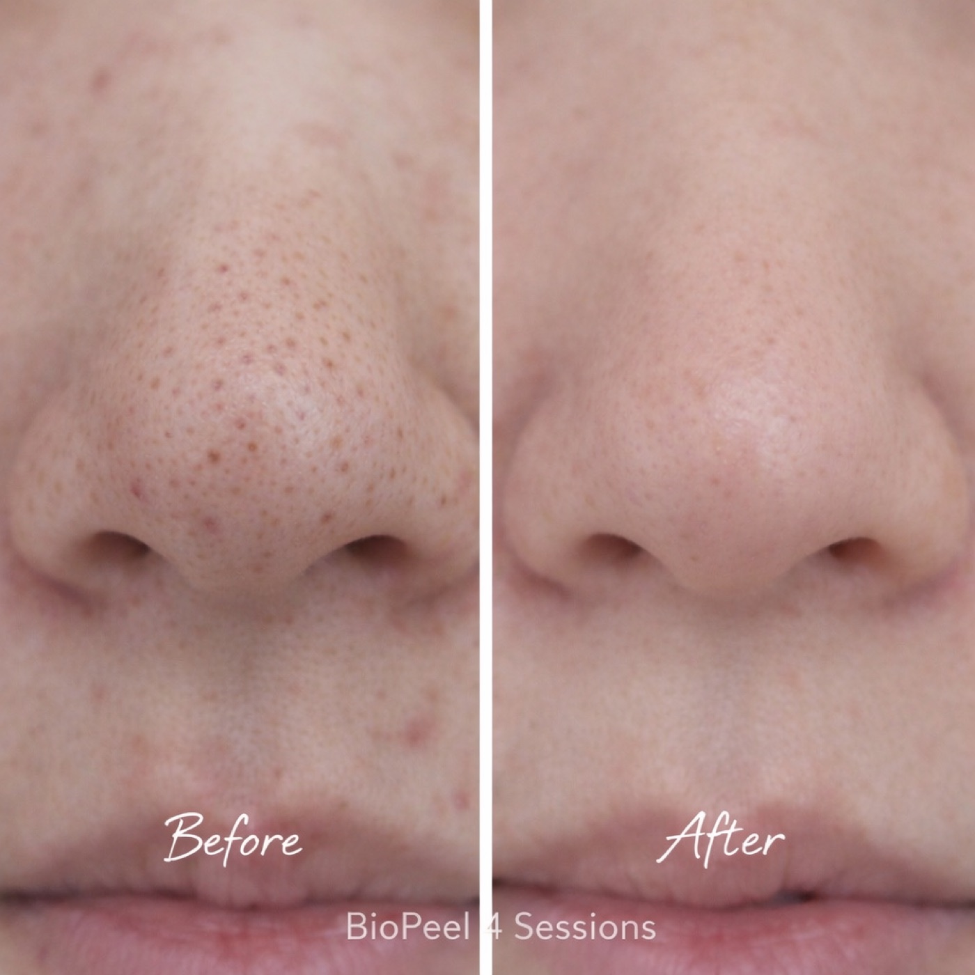 Facial — Before & After 7