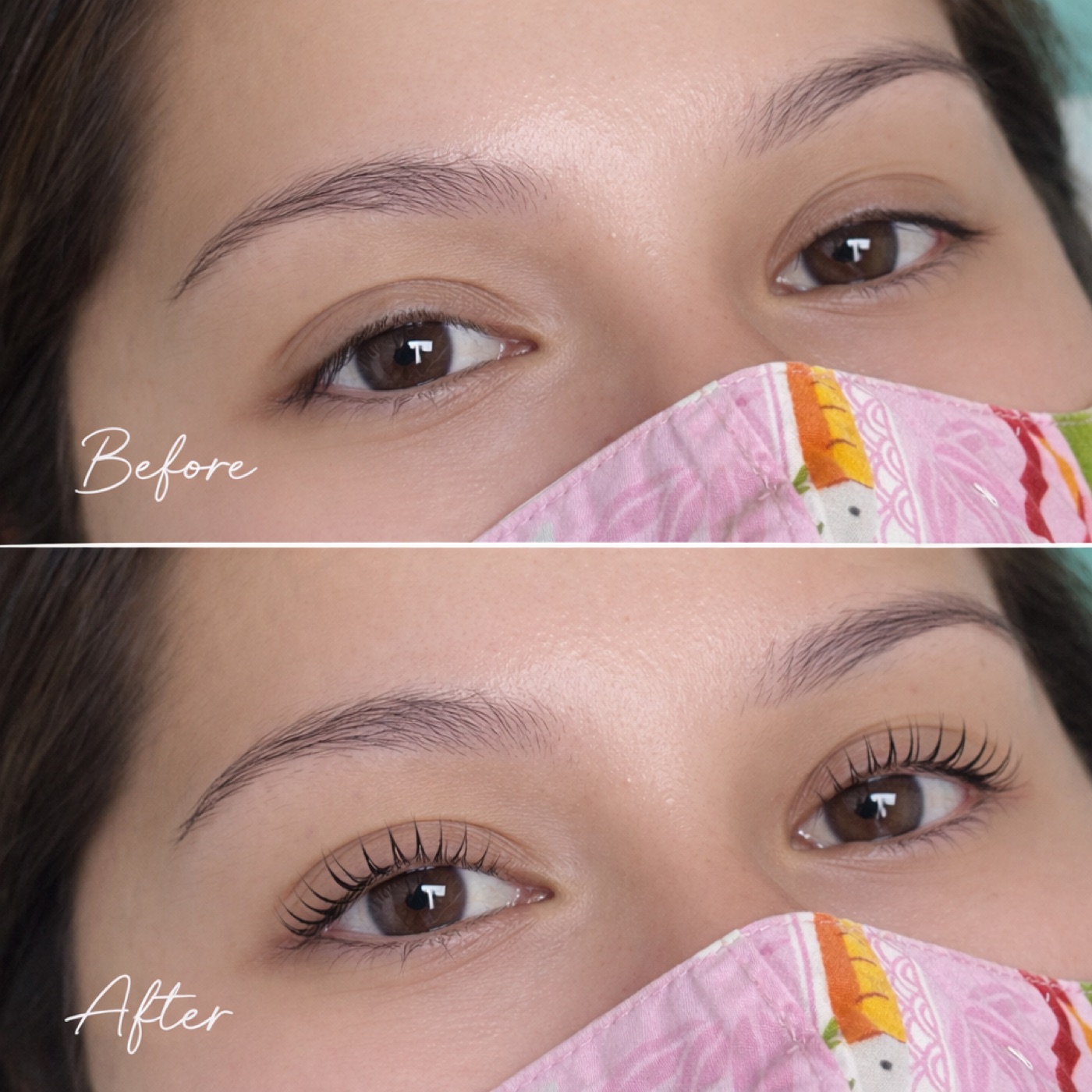 Before and after