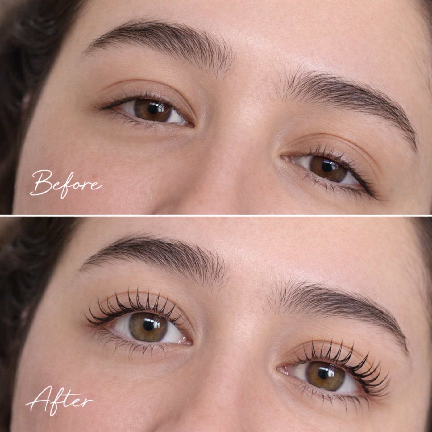 Before and after